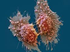 ابتكار عقار يدمّر الخلايا السرطانية