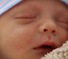 "في حالة نادرة" ولادة طفل بدون عيون في سورية