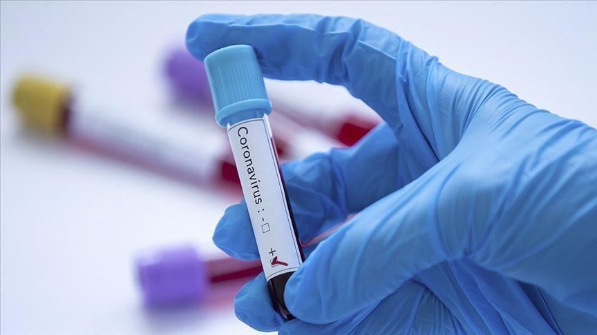 وكالة الأنباء الأردنية: تسجيل أول حالة إصابة بفيروس كورونا في البلاد
