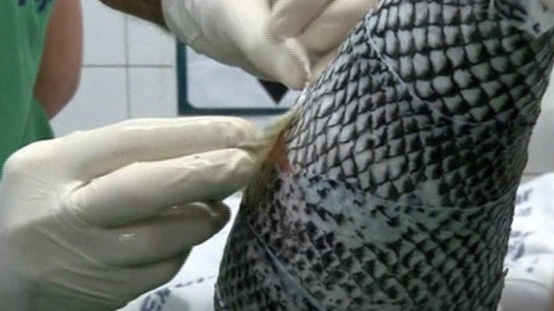 علاج الحروق باستخدام جلد السمك (صور)
