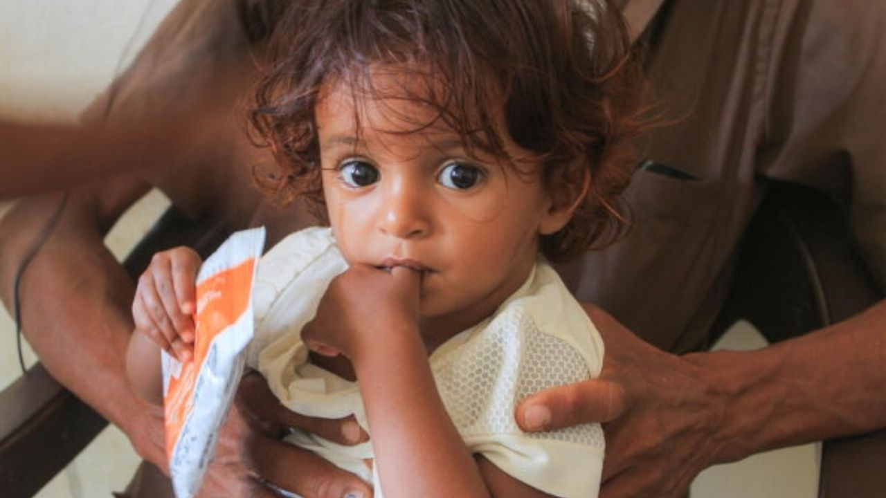 صحيفة الغارديان البريطانية: 5 ملايين يمني على شفا المجاعة.. و16 مليون آخرين مهددون