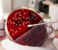 تعرف على أهمية معرفة فصيلة دمك وعلاقتها بالأمراض
