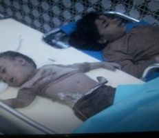 "الجوع" يقتل 6 أشخاص في اليمن