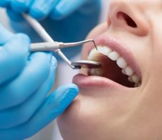 نقيب أطباء الأسنان: ضمير الطبيب ورقابة النقابة هما فقط من يضبطان عمل طبيب الأسنان