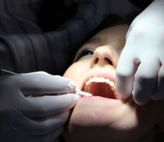 الحبس شهرين لطبيب أسنان أردني خلع السن وترك الجذر