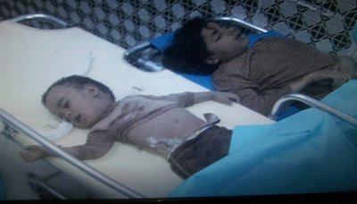 "الجوع" يقتل 6 أشخاص في اليمن