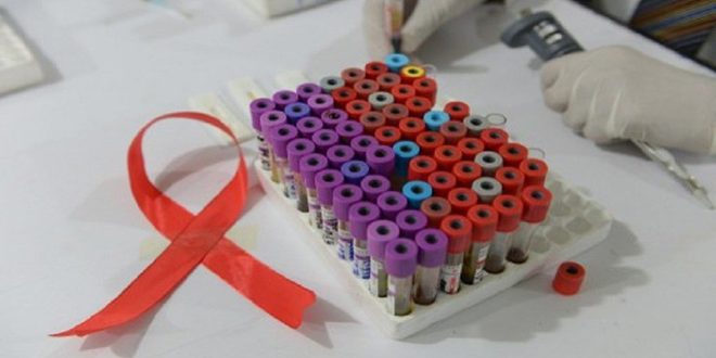 "جهاز قابل للزرع" يحمي من الإصابة بفيروس نقص المناعة