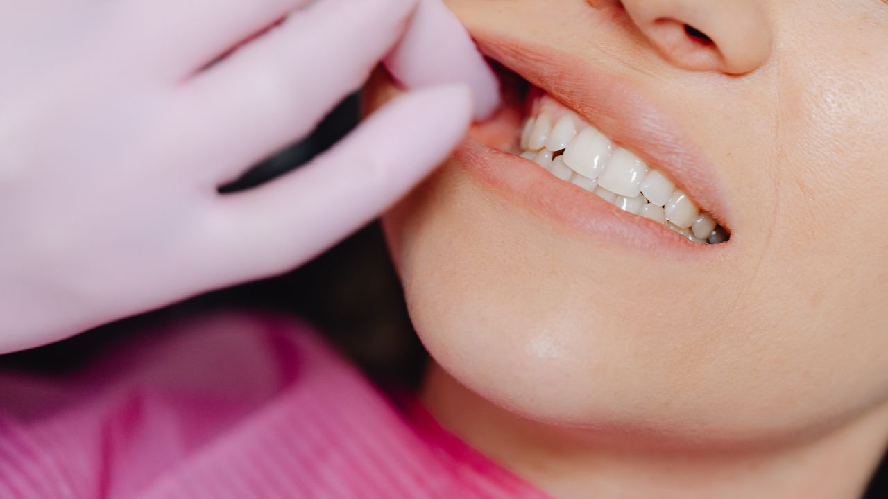 منظمة الصحة العالمية: نحو نصف سكان العالم يعانون من أمراض الفم
