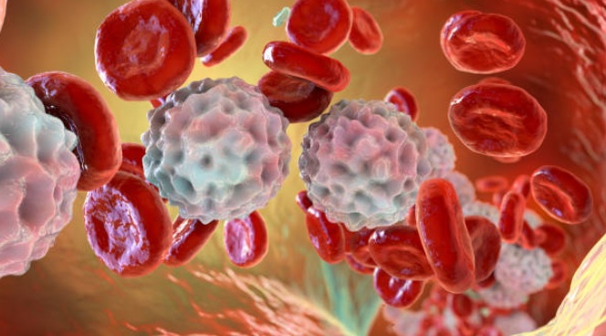 أطباء بريطانيون يقدّمون علاجاً رائداً لأحد أنواع سرطان الدم