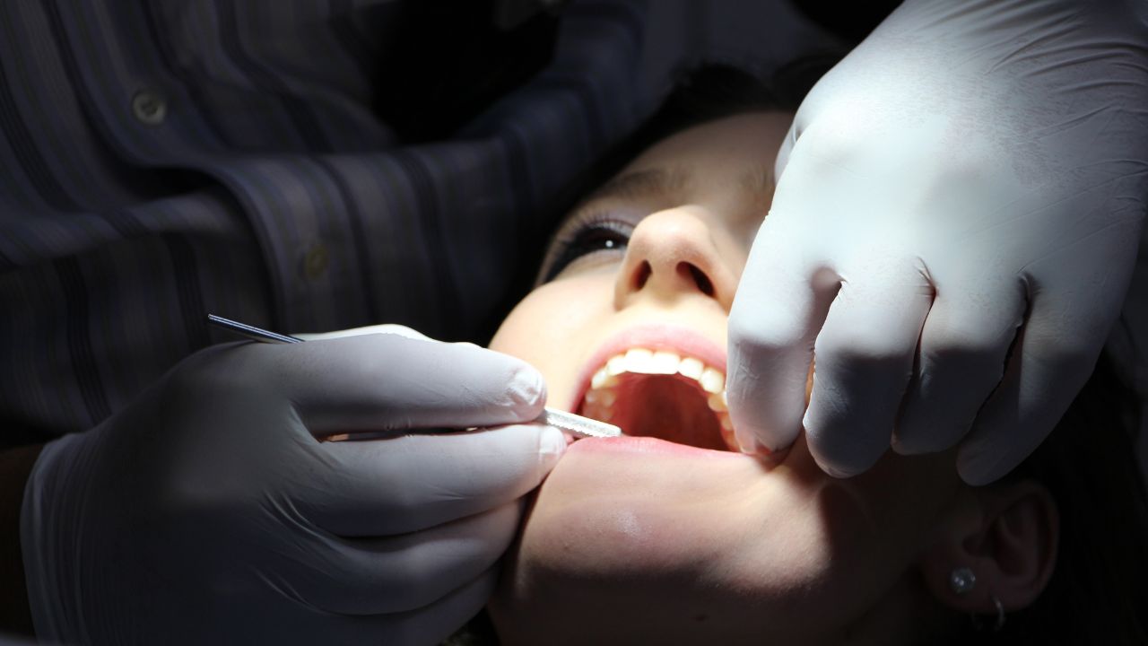 الحبس شهرين لطبيب أسنان أردني خلع السن وترك الجذر